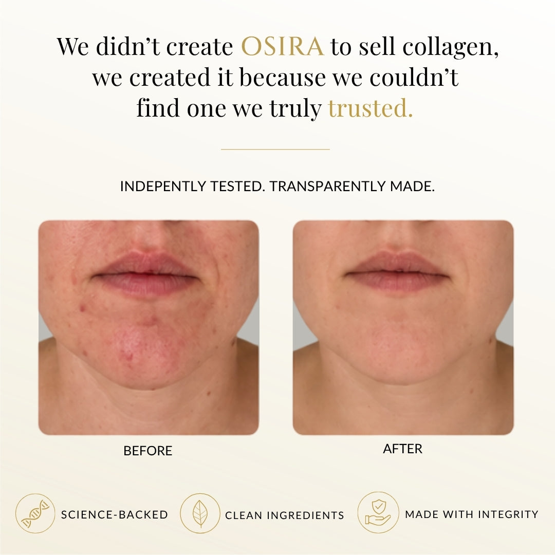 Marine Collagen Ultra